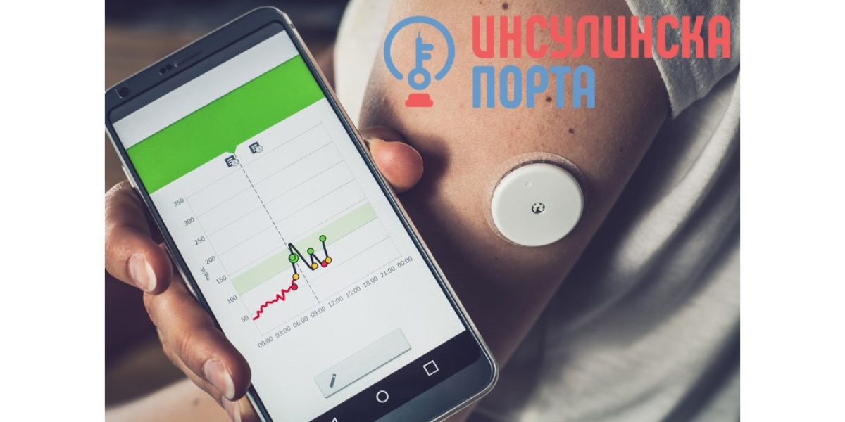 glucose-monitor